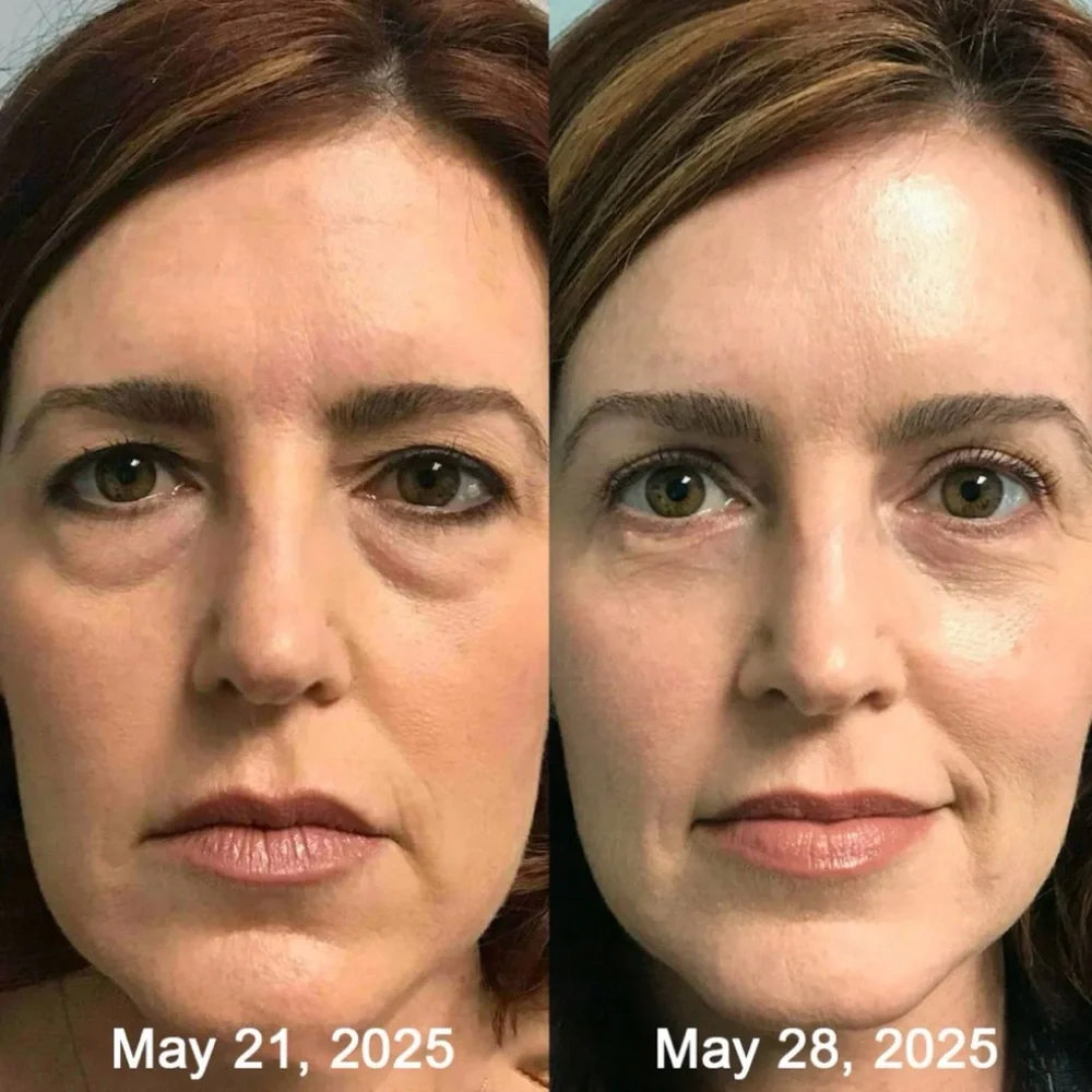 Botox & Retinol Shot Anti-Aging Cream